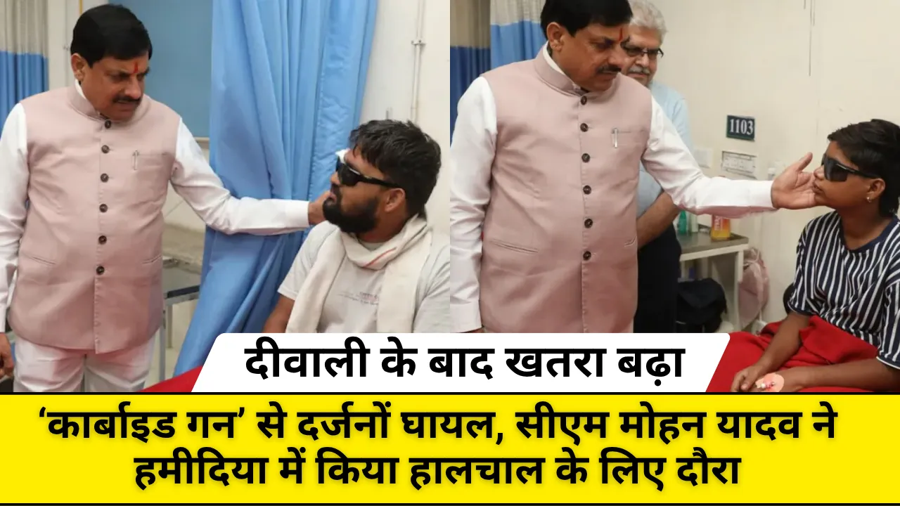 दीवाली के बाद खतरा बढ़ा — ‘कार्बाइड गन’ से दर्जनों घायल; सीएम मोहन यादव ने हमीदिया में किया हालचाल के लिए दौरा